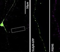 Brain nerve cells